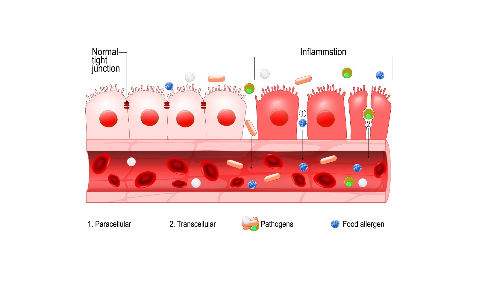 bioptimizers leaky gut support